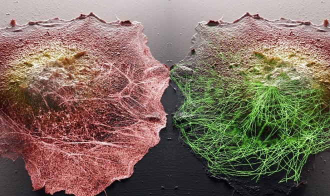 Новая технология дает невероятные возможности наблюдения за внутренней жизнью клеток 
